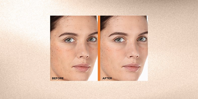 In Article Ruddy Skin Color Bright Reveal Vitamin C Moisturizer